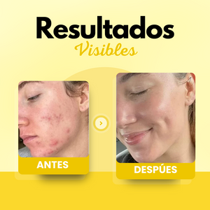 Bálsamo de Sebo de Res Para Reparación